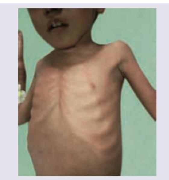 Image for question 360