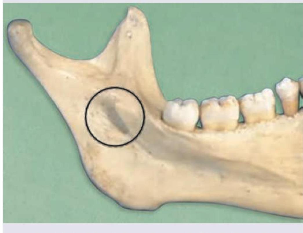 Image for question 10