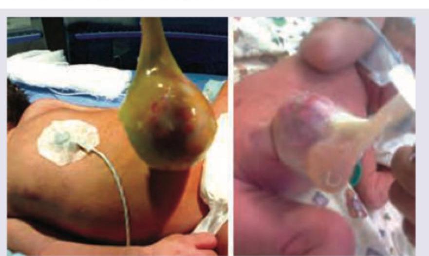 Image for question 996