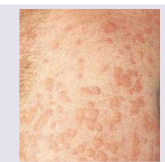 Image for question 19