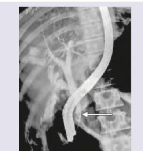 Image for question 169