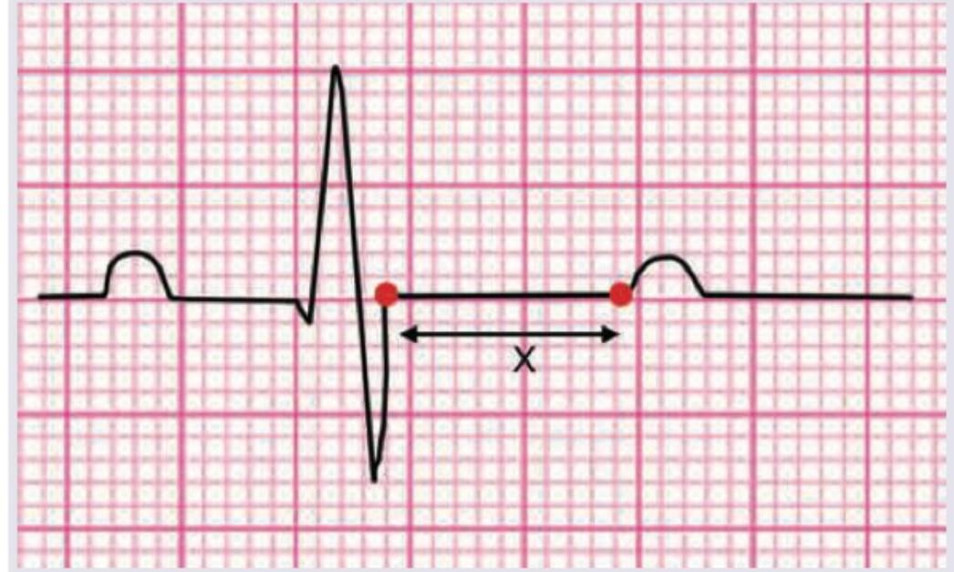 Image for question 737