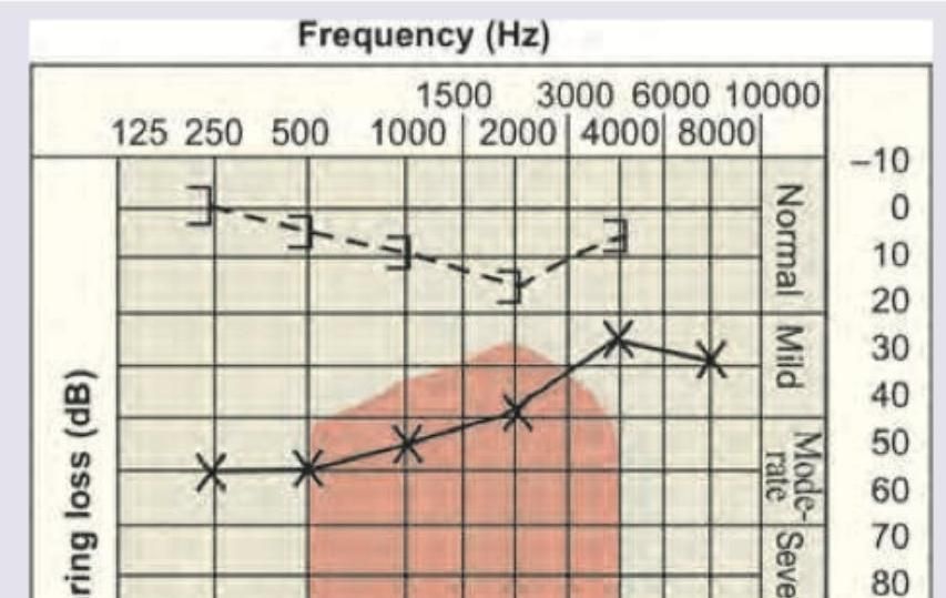 Image for question 204