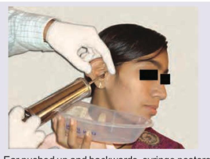 Image for question 191