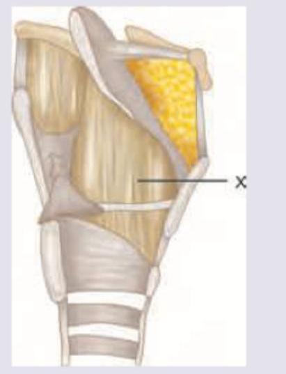 Image for question 1167