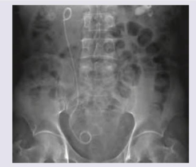 Image for question 936