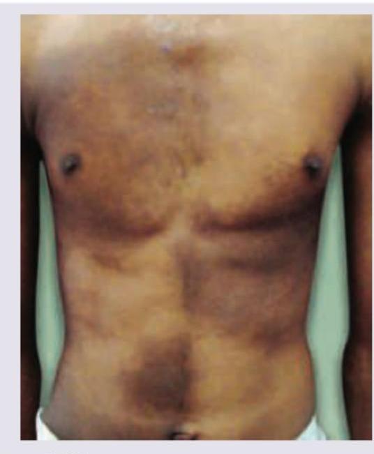 Image for question 86