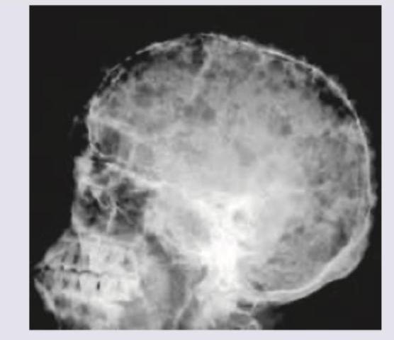 Image for question 133