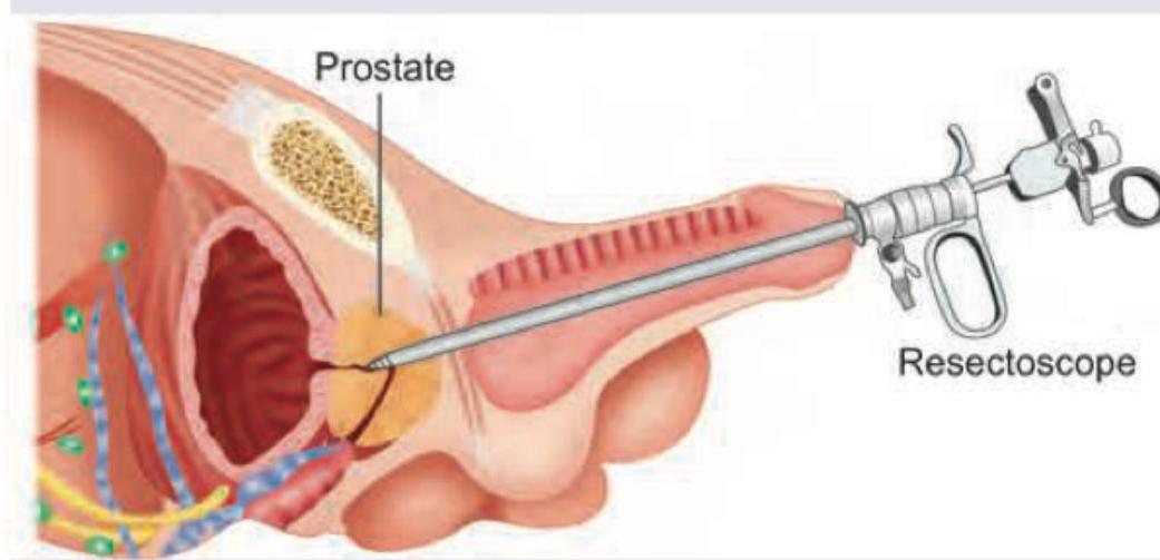 Image for question 940