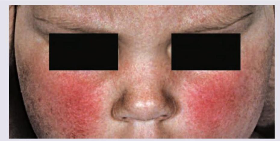 Image for question 355