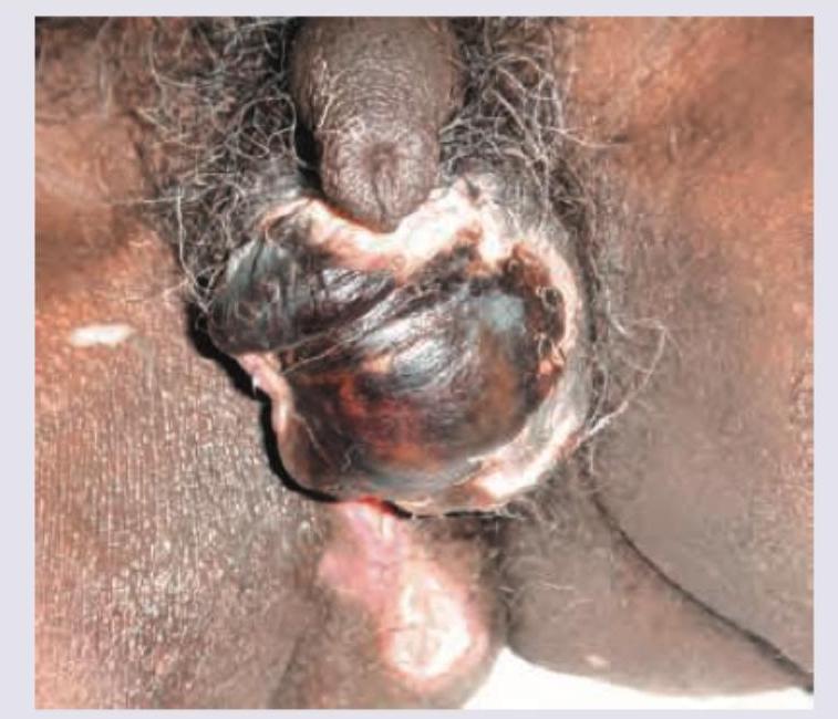 Image for question 98