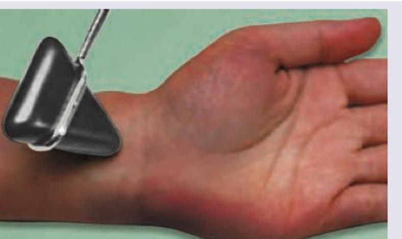 Image for question 70