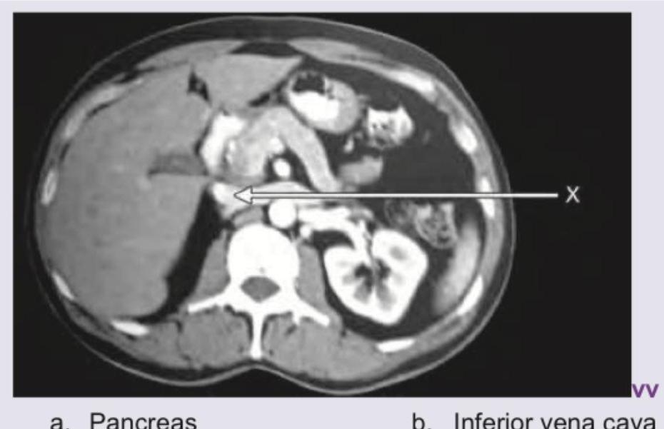 Image for question 121