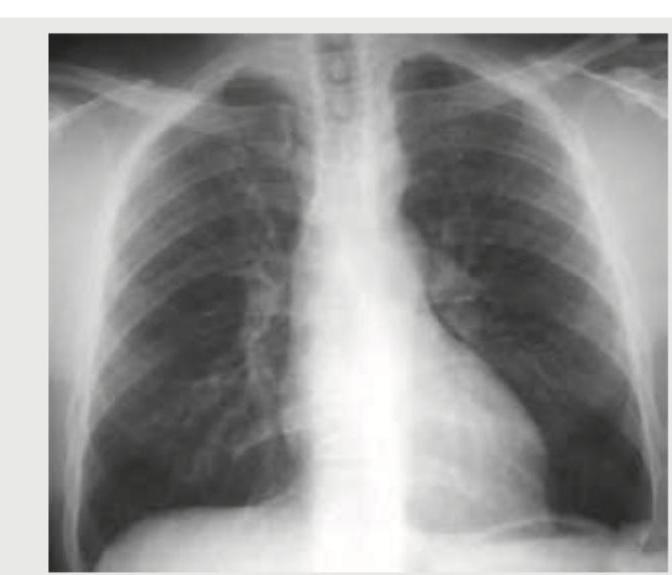 Image for question 102