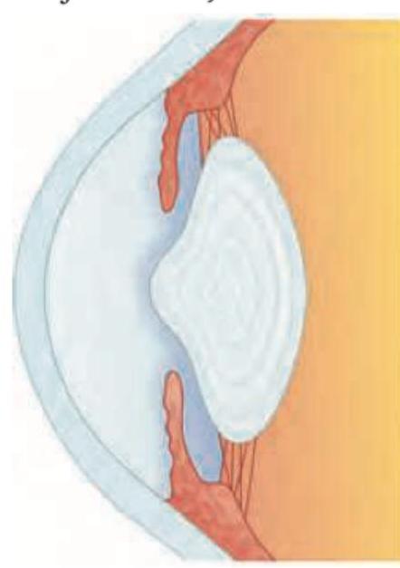 Image for question 449