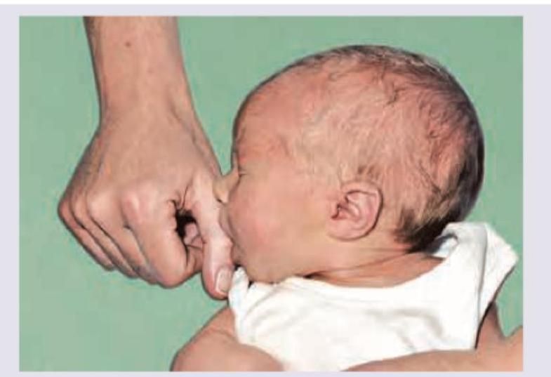 Image for question 647