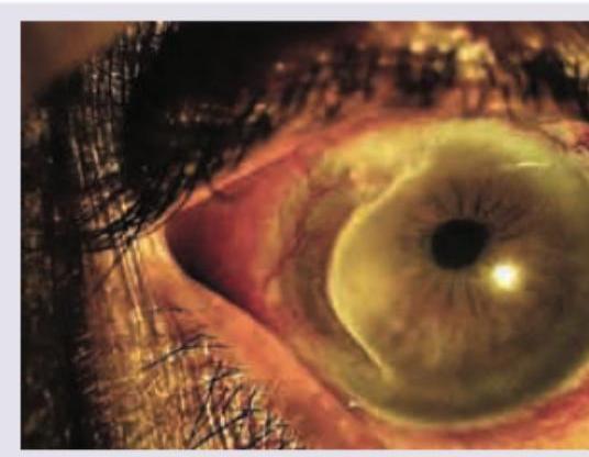 Image for question 315