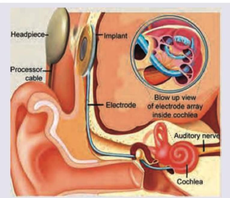 Image for question 199