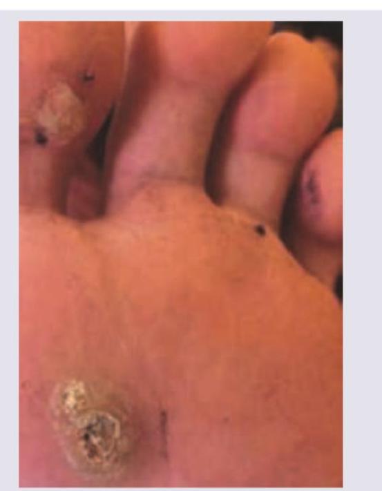 Image for question 169