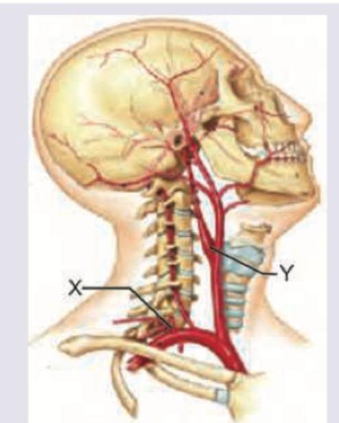 Image for question 346