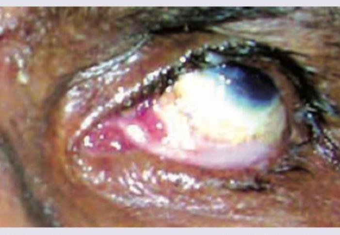 Image for question 35