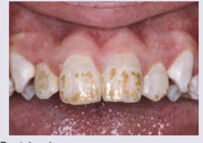 Image for question 662