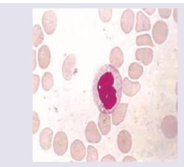 Image for question 364