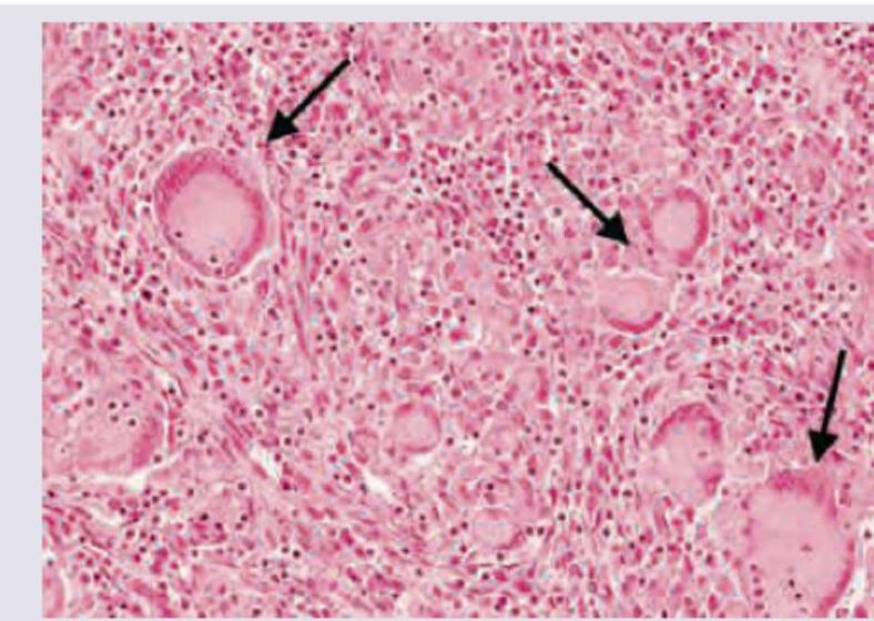 Image for question 366