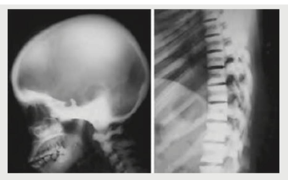 Image for question 139