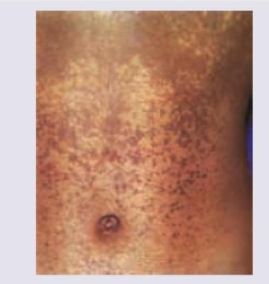 Image for question 116