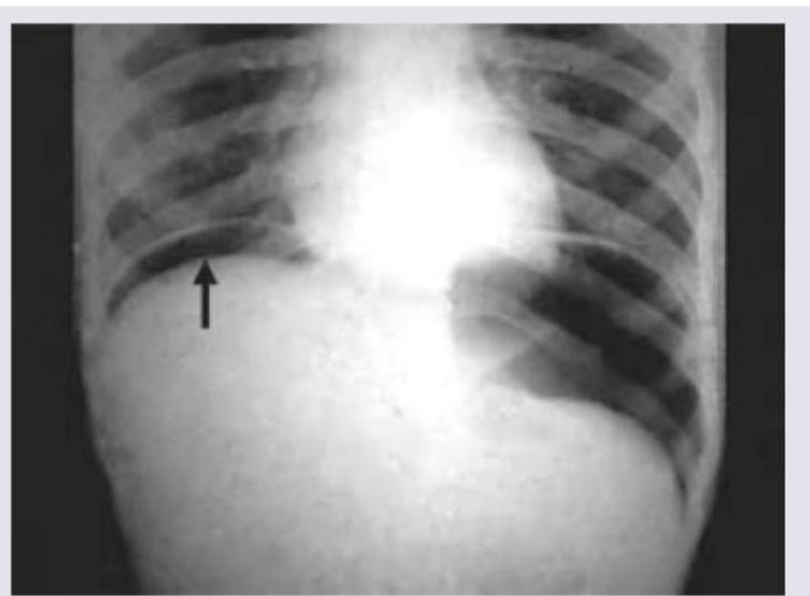 Image for question 785