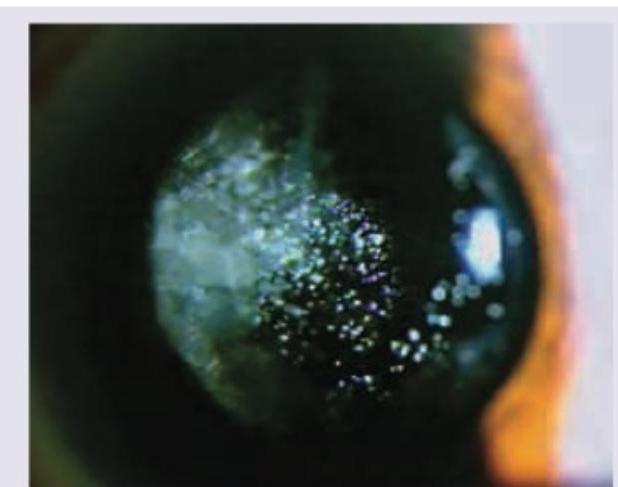 Image for question 462