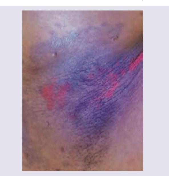 Image for question 258