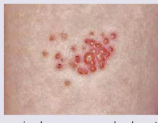 Image for question 165