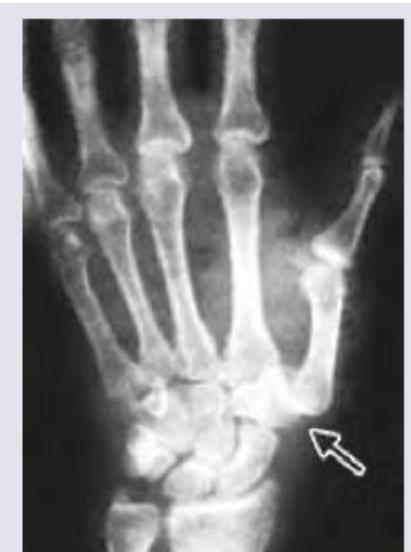 Image for question 71