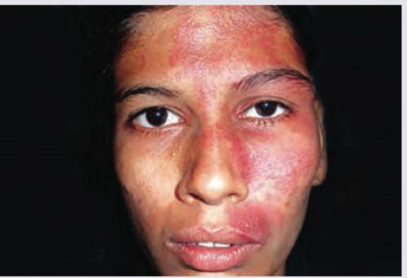 Image for question 53