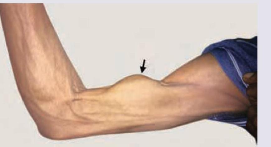 Image for question 919