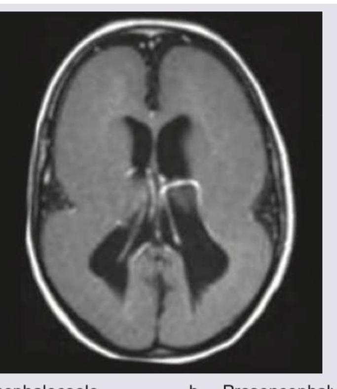 Image for question 615