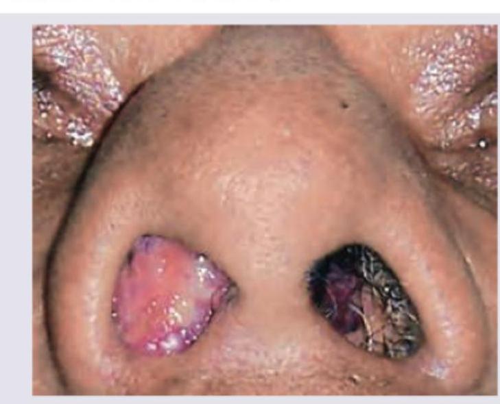 Image for question 336