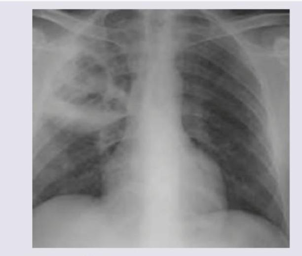 Image for question 2058