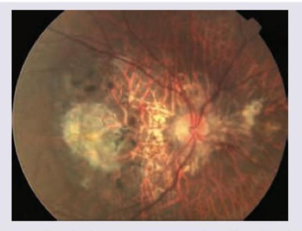 Image for question 449