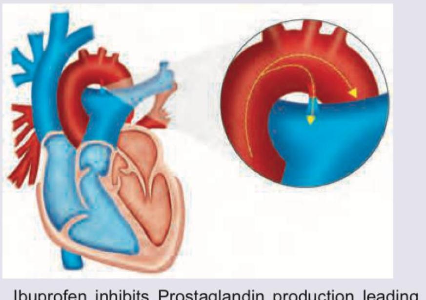 Image for question 285