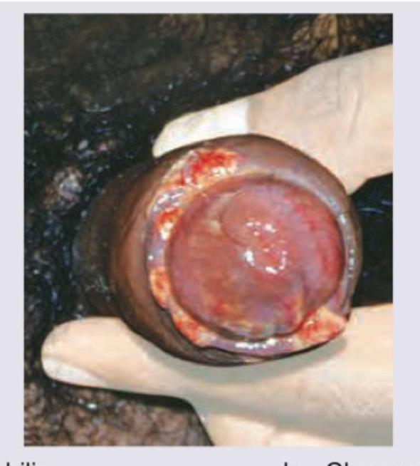 Image for question 162