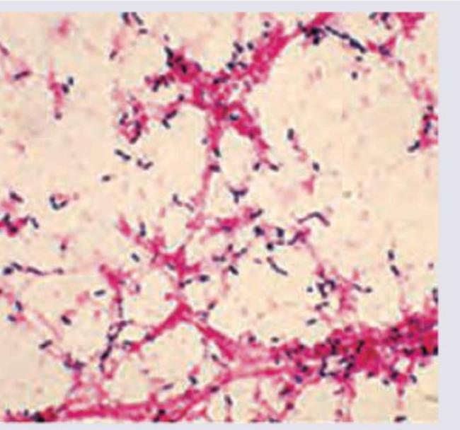 Image for question 282