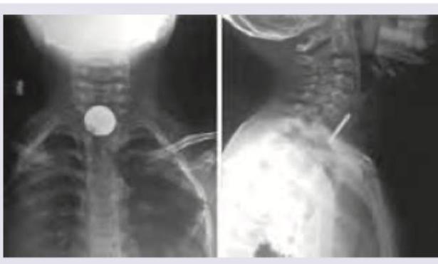 Image for question 255