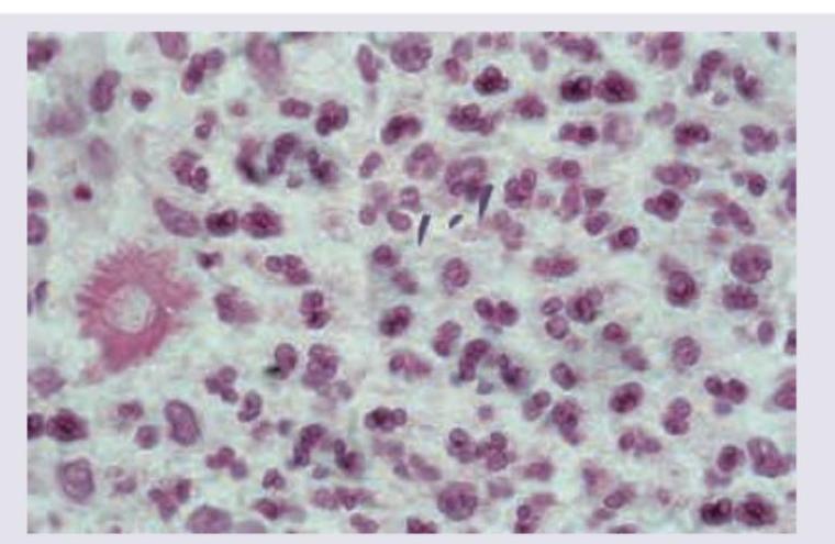 Image for question 103