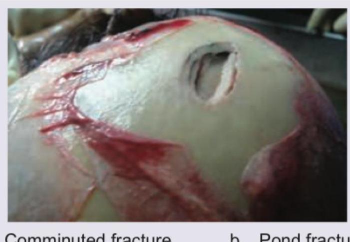 Image for question 511