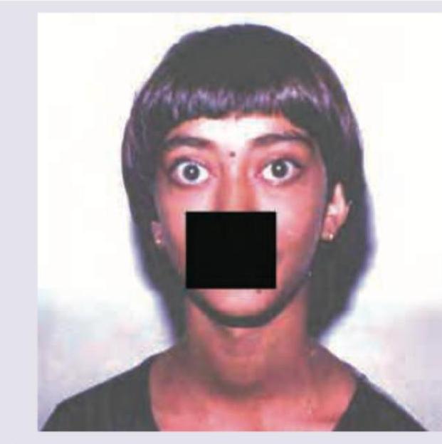 Image for question 836