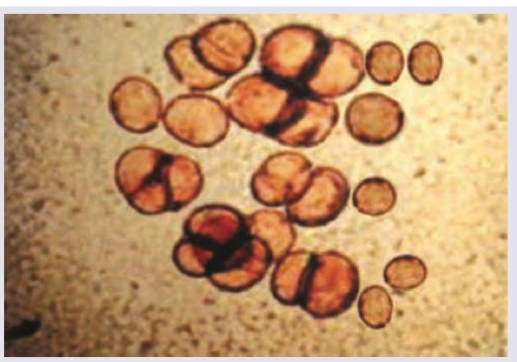 Image for question 105