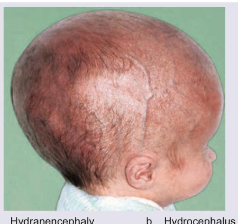 Image for question 203